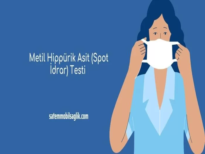 Metil Hippürik Asit (Spot İdrar) Testi 